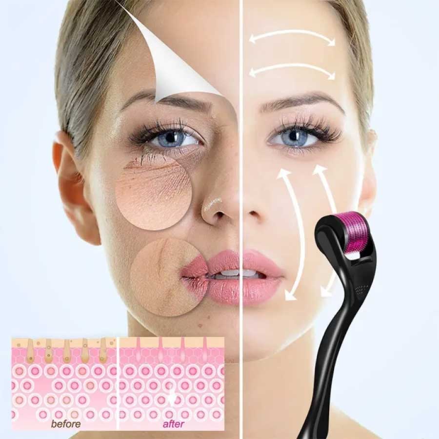 Derma roller for hair growth - Derma roller For Skin 0.5 mm - Microneedle for Acne Scars Wrinkles digonto mart